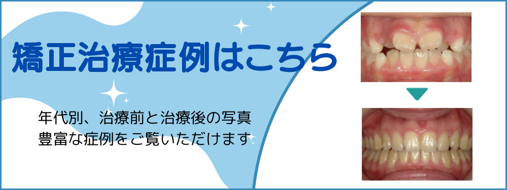症例はこちら